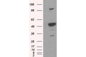 Western Blotting (WB) image for anti-Proteasome (Prosome, Macropain) 26S Subunit, ATPase, 3 (PSMC3) antibody (ABIN1501332) (PSMC3 Antikörper)