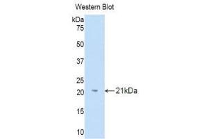 Western Blotting (WB) image for anti-Interleukin 18 Binding Protein (IL18BP) (AA 31-194) antibody (ABIN1859371) (IL18BP Antikörper  (AA 31-194))