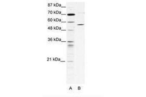 Image no. 1 for anti-Chaperonin Containing TCP1, Subunit 4 (Delta) (CCT4) (AA 453-502) antibody (ABIN202730) (CCT4 Antikörper  (AA 453-502))