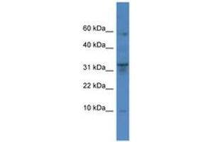 Image no. 1 for anti-Cathepsin C (CTSC) (AA 185-234) antibody (ABIN6746757)