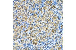 Immunohistochemistry (Paraffin-embedded Sections) (IHC (p)) image for anti-Heat Shock 70kDa Protein 9 (Mortalin) (HSPA9) (AA 380-679) antibody (ABIN3021000)