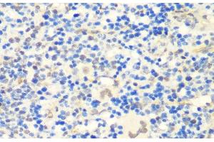 Immunohistochemistry of paraffin-embedded Rat spleen using CTCF Polyclonal Antibody at dilution of 1:200 (40x lens). (CTCF Antikörper)