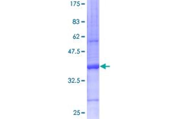 Mammaglobin A Protein (AA 1-93) (GST tag)