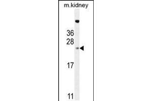 Western blot analysis in mouse kidney tissue lysates (35ug/lane). (ADO Antikörper  (C-Term))