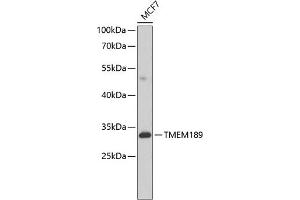 Western blot analysis of extracts of MCF-7 cells, using TMEM189 antibody (ABIN6134447, ABIN6149262, ABIN6149263 and ABIN6224423) at 1:1000 dilution. (TMEM189 Antikörper  (C-Term))