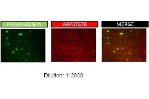 Immunohistochemistry (IHC) image for anti-Potassium Voltage-Gated Channel, Shaker-Related Subfamily, beta Member 2 (KCNAB2) (Middle Region) antibody (ABIN2780205)