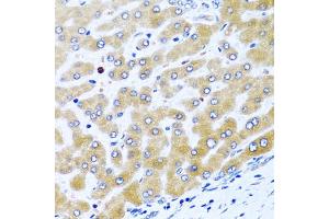 Immunohistochemistry of paraffin-embedded human liver using CCL21 antibody (ABIN5970974) at dilution of 1/100 (40x lens).