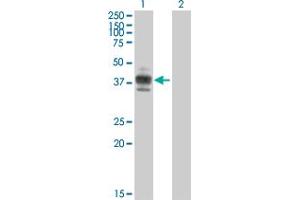 Western Blot analysis of CD2 expression in transfected 293T cell line by CD2 MaxPab polyclonal antibody. (CD2 Antikörper  (AA 1-351))
