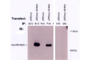 Image no. 1 for anti-Nephronophthisis 1 (Juvenile) (NPHP1) antibody (ABIN264966) (NPHP1 Antikörper)