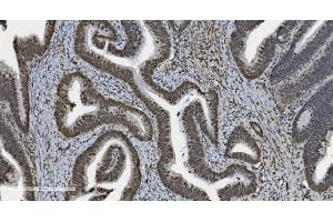 IHC analysis of U2AF65/U2AF2 using anti U2AF65/U2AF2 antibody (ABIN7600795).