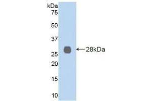 Detection of Recombinant LOXL2, Human using Polyclonal Antibody to Lysyl Oxidase Like Protein 2 (LOXL2) (LOXL2 Antikörper  (AA 544-751))