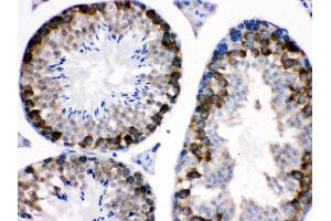 nti- Stathmin 1 Picoband antibody, IHC(P) IHC(P): Mouse Testis Tissue (Stathmin 1 Antikörper  (N-Term))