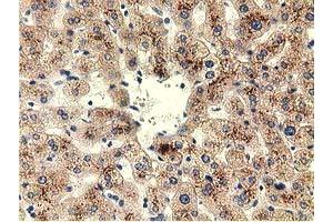 Immunohistochemical staining of paraffin-embedded Human liver tissue using anti-THOP1 mouse monoclonal antibody. (Thimet Oligopeptidase 1 Antikörper)
