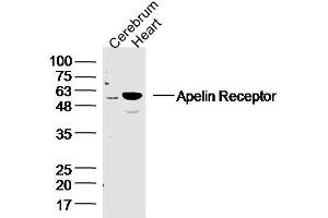 Mouse cerebrum and heart lysates probed with APJ Receptor Polyclonal Antibody, unconjugated  at 1:300 overnight at 4°C followed by a conjugated secondary antibody at 1:10000 for 90 minutes at 37°C. (Apelin Receptor Antikörper  (AA 52-66))