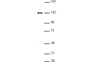 SALL4 antibody (pAb) tested by Western blot. (SALL4 Antikörper  (N-Term))