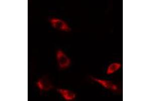 ABIN6274489 staining HeLa cells by IF/ICC. (DUSP9 Antikörper  (Internal Region))