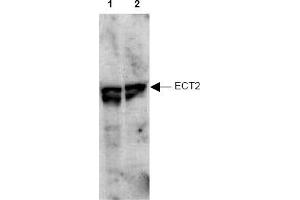 Image no. 1 for anti-Epithelial Cell Transforming Sequence 2 Oncogene (ECT2) (AA 785-795), (pThr790) antibody (ABIN401345) (ECT2 Antikörper  (pThr790))
