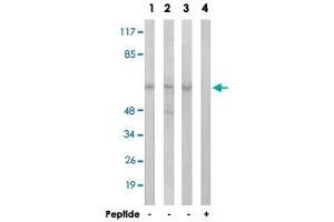 Western blot analysis of extracts from HeLa cells (Lane 1), Jurkat cells (Lane 2) and A-549 cells (Lane 3 and lane 4), using AGBL4 polyclonal antibody . (AGBL4 Antikörper)