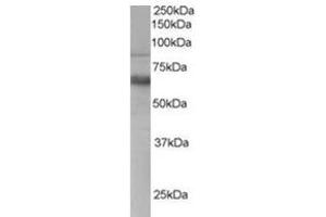 Image no. 1 for anti-anthrax Toxin Receptor 1 (ANTXR1) (C-Term) antibody (ABIN374464) (ANTXR1 Antikörper  (C-Term))