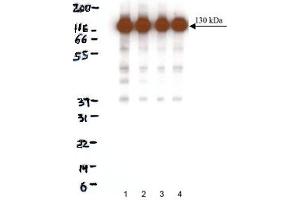Western Blotting (WB) image for anti-Cadherin 2 (CDH2) (AA 802-819) antibody (ABIN968250) (N-Cadherin Antikörper  (AA 802-819))