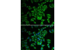 Immunofluorescence analysis of A549 cell using FXN antibody. (Frataxin Antikörper)