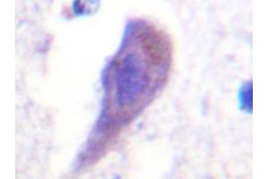 Immunohistochemistry analyzes of HRS Antibody in paraffin-embedded human brain tissue. (HGS Antikörper)