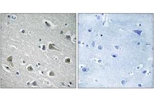 Immunohistochemistry analysis of paraffin-embedded human brain tissue, using MYLIP Antibody. (MYLIP Antikörper  (AA 161-210))
