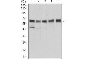 Western Blotting (WB) image for anti-Aldehyde Dehydrogenase 6 Family, Member A1 (ALDH6A1) (AA 1-195) antibody (ABIN5856297) (ALDH6A1 Antikörper  (AA 1-195))