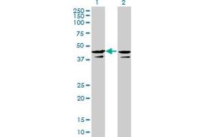 CSNK2A1/CK II alpha Antikörper  (AA 1-100)