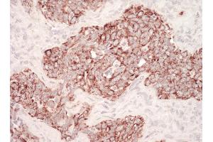 Immunohistochemistry (IHC) image for anti-Heat Shock 60kDa Protein 1 (Chaperonin) (HSPD1) (AA 250-300) antibody (ABIN7454873)