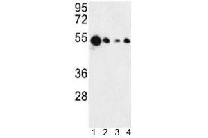 Western Blotting (WB) image for anti-Absent in Melanoma 2 (AIM2) (AA 1-50) antibody (ABIN3029828)