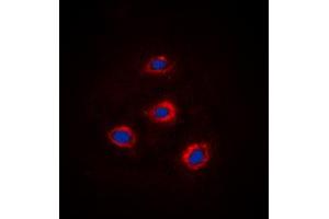 Immunofluorescent analysis of Alpha-adducin staining in HEK293 cells.
