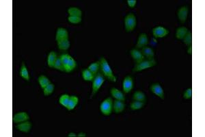 Immunofluorescent analysis of HepG2 cells using ABIN7150009 at dilution of 1:100 and Alexa Fluor 488-congugated AffiniPure Goat Anti-Rabbit IgG(H+L) (ATPBD4 Antikörper  (AA 8-267))