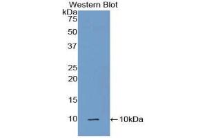 Western Blotting (WB) image for anti-Complement Component 5a (C5a) (AA 679-755) antibody (ABIN3208723) (C5A Antikörper  (AA 679-755))
