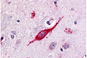 Immunohistochemical (Formalin/PFA-fixed paraffin-embedded sections) staining in human brain, neuron with GPR85 polyclonal antibody . (GPR85 Antikörper  (C-Term))
