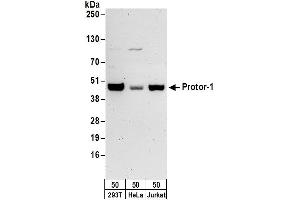 anti-Proline Rich 5 (Renal) (PRR5) (AA 338-388) antibody