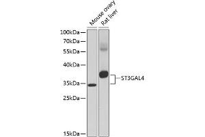 Western blot analysis of extracts of various cell lines, using ST3G antibody (ABIN6130192, ABIN6148529, ABIN6148531 and ABIN6217583) at 1:1000 dilution. (ST3GAL4 Antikörper  (AA 27-267))