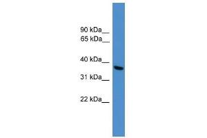 Western Blot showing UCHL5 antibody used at a concentration of 1-2 ug/ml to detect its target protein.