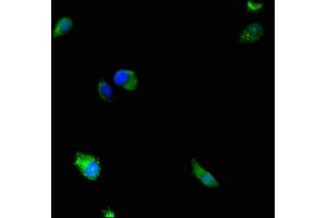 Immunofluorescence staining of Hela cells with ABIN7150717 at 1:233, counter-stained with DAPI. (MAP2K5 Antikörper  (AA 1-190))