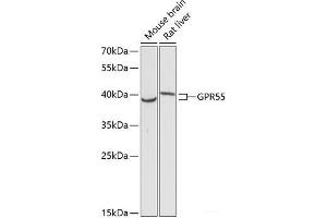 Western blot analysis of extracts of various cell lines using GPR55 Polyclonal Antibody at dilution of 1:3000. (GPR55 Antikörper)