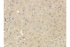 ABIN6265479 and ABIN6273328 at 1/100 staining human normal liver tissue by IHC-P. (TBC1D23 Antikörper  (Internal Region))