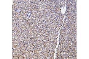 IHC analysis of HP using anti-HP antibody (ABIN7600401).