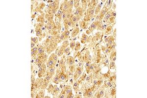 Antibody staining GAA in Human liver tissue sections by Immunohistochemistry (IHC-P - paraformaldehyde-fixed, paraffin-embedded sections). (GAA Antikörper  (N-Term))