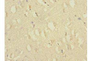 Immunohistochemistry of paraffin-embedded human brain tissue using ABIN7175576 at dilution of 1:100 (CACNG7 Antikörper  (AA 156-275))