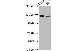Western Blot Positive WB detected in: Hela whole cell lysate, U87 whole cell lysate All lanes: SLC4A5 antibody at 2.