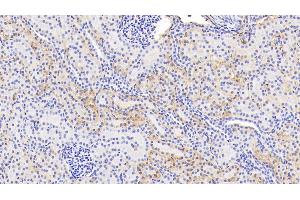 Detection of HbA1c in Human Kidney Tissue using Polyclonal Antibody to Glycated Hemoglobin A1c (HbA1c) (HbA1c Antikörper)