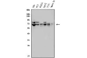 Western blot analysis of FRMD6 using anti-FRMD6 antibody (ABIN7599577). (FRMD6 Antikörper  (AA 1-95))