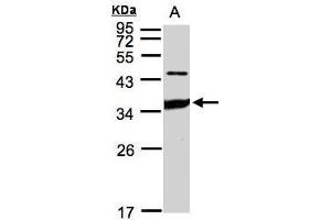 WB Image Sample(30 ug whole cell lysate) A:HeLa S3, 12% SDS PAGE antibody diluted at 1:1000 (ICAM2 Antikörper)