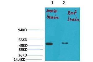 Western Blot (WB) analysis of 1) Mouse Brain Tissue, 2)Rat Brain Tissue with KV1. (Kv1.1 Potassium Channel Antikörper)