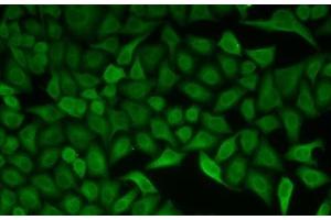 Immunofluorescence analysis of HeLa cells using CDC34 Polyclonal Antibody (CDC34 Antikörper)